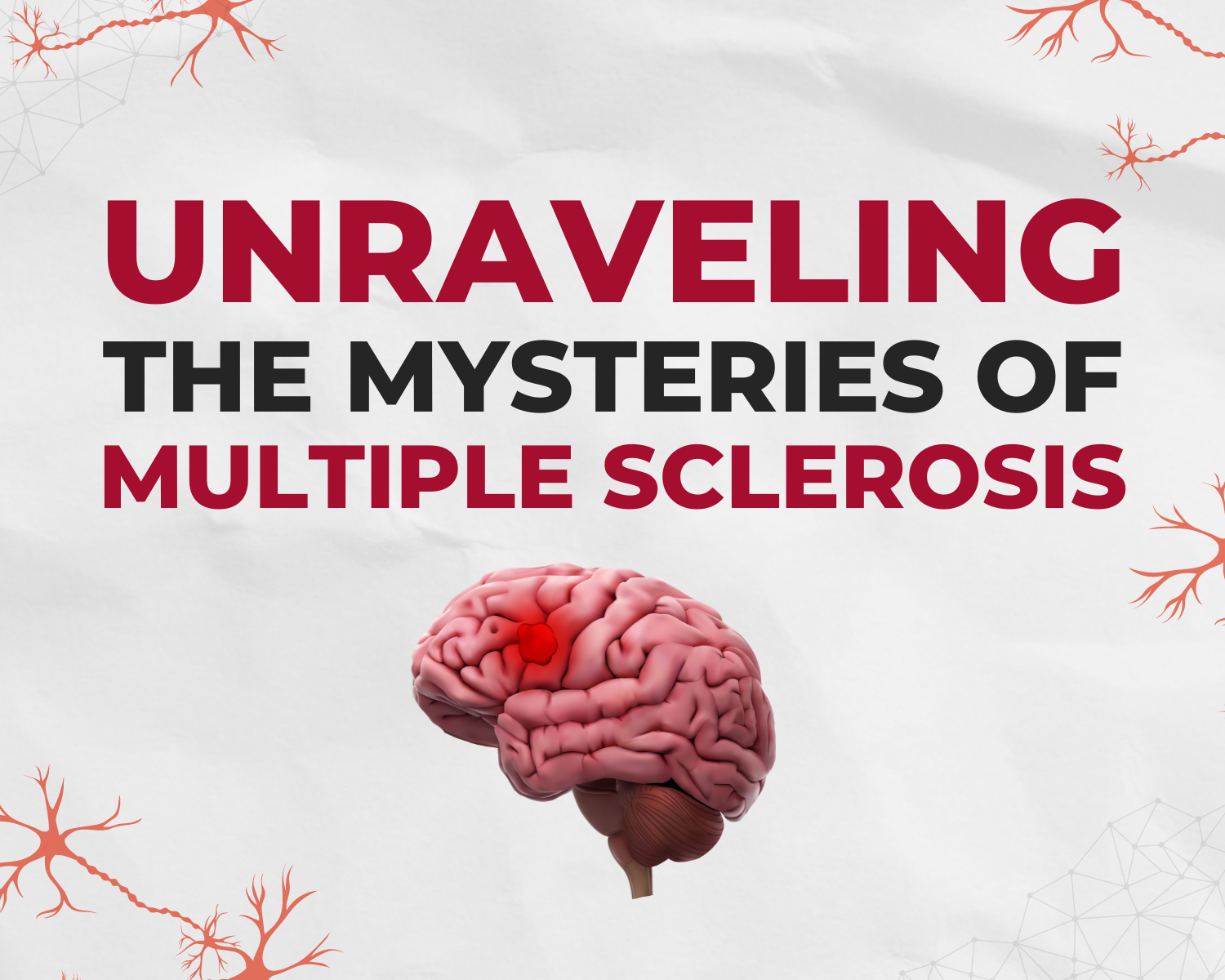 Unraveling The Mysteries Of Multiple Sclerosis